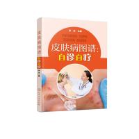 皮肤病图谱:自诊自疗