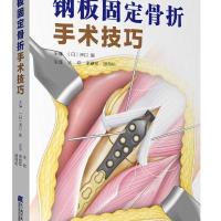 钢板固定骨折手术技巧