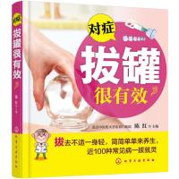 123 对症拔罐很有效