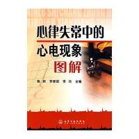 心律失常中的心电现象图解