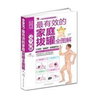 有效的家庭拔罐完全图解