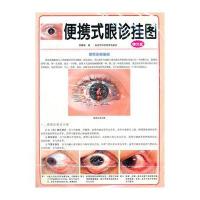 便携式眼诊挂图