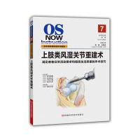 上肢类风湿关节重建术