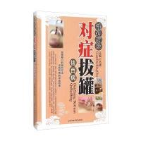 罐到病除对症拔罐祛百病