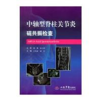 中轴型脊柱关节炎磁共振检查