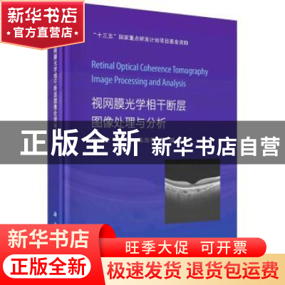 正版 视网膜光学相干断层图像处理与分析 陈新建,石霏,陈浩宇,