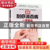 正版 图解刮痧消百病一学就会 郑书敏,孙平 江苏凤凰科学技术出版