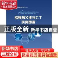 正版 结核病X线与CT实例图谱 吕圣秀,陈耀凯编著 重庆大学出版社