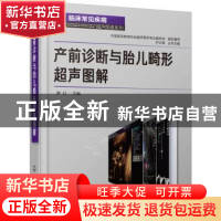 正版 产前诊断与胎儿畸形超声图解 罗红 主编 化学工业出版社 978