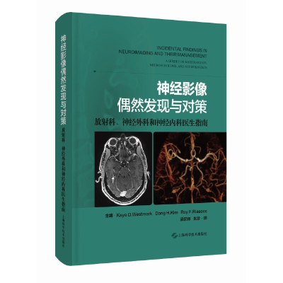 正版新书]神经影像偶然发现与对策:放科、神经外科和神经内科医