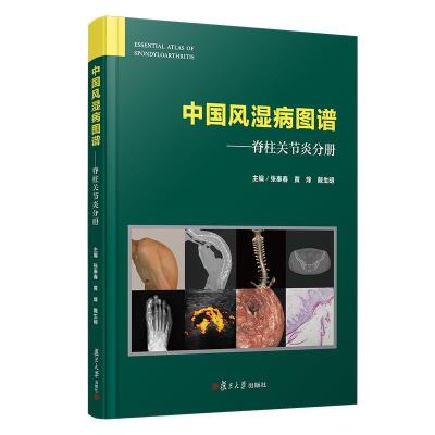 正版新书]中国风湿病图谱:脊柱关节炎分册(中国风湿病图谱)不