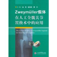 正版新书]Zweymuller假体在人工全髋关节置换术中的应用吕龙等编