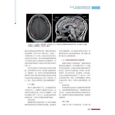 正版新书]脑转移瘤放射治疗学 基于病例的研究(美)山田吉屋 等97