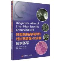 正版新书]肝胆疾病高特异性对比剂增强MR诊断:病例荟萃赵心明宋