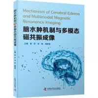 正版新书]脑水肿机制与多模态磁共振成像鲁宏 , 刘衡 , 战跃福97