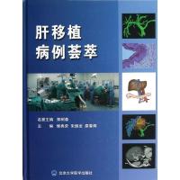 正版新书]肝移植病例荟萃修典荣9787565903694