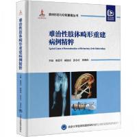 正版新书]难治性肢体畸形重建病例精粹(配视频)(肢体形态与功