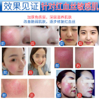 2盒 妍瑟 冻干粉多肽滋养精华液深层修护改善痘印痘坑红血丝滋润营养紧肤淡皱补水保湿适用各种肤质男女通用