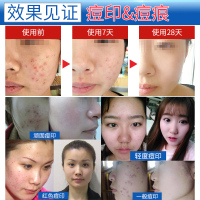 2盒 妍瑟 冻干粉多肽滋养精华液深层修护改善痘印痘坑红血丝滋润营养紧肤淡皱补水保湿适用各种肤质男女通用