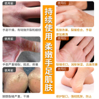 2支装 妍瑟30g马油清足膏护足霜滋润营养 脚干脚裂起皮脚气膏改善冻裂男女通用 适用各种肤质
