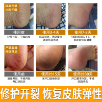 2支装 妍瑟30g马油清足膏护足霜滋润营养 脚干脚裂起皮脚气膏改善冻裂男女通用 适用各种肤质