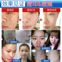 6盒 妍瑟 冻干粉多肽滋养精华液修护受损肌肤祛痘坑痘印红血丝滋养保湿适用各种肤质男女通用