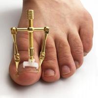 甲沟嵌甲矫正贴脚趾甲矫正器指甲刀剪脚沟指甲炎矫正器-门字形矫正器