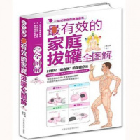 z有效的家庭拔罐完全图解 常见病 家庭医生 养生书籍 家庭保健疗法养生穴位书籍 正版