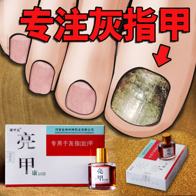 买2送1 [告别灰指甲]灰指甲药灰指甲药亮甲康 特效亮甲灰25ml