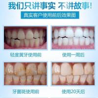 蓝光清洁美牙仪神器速效冷光牙齿仪去烟渍洁牙器大牙洗牙器