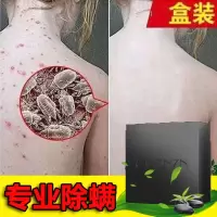 [专业去螨虫]背上背后脸上胸前祛痘控油洗脸全身男女可用皂