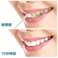 [牙齿一次见效]牙斑净速效去除去牙烟牙菌斑牙垢黑渍牙粉
