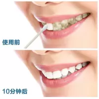 [牙齿一次见效]牙斑净速效去除去牙烟牙菌斑牙垢黑渍牙粉