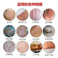 本疤痕灵马油霜去疤痕修复祛遮疤膏祛疤产品手术疤烧烫伤妊娠纹