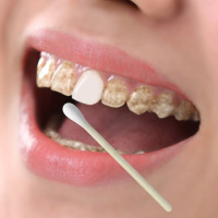 芽秀牙斑净去烟渍神器牙齿洁牙去除牙渍牙白牙素洗牙粉