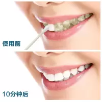 [三瓶装]牙齿速效去牙烟斑牙垢黑渍洗牙粉液牙膏神器白牙