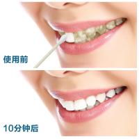 [25万人见证 一擦见效]牙斑净速效去除 烟渍 咖啡渍 茶渍食 物色素等引起的黑牙 10ml牙齿 一次见效