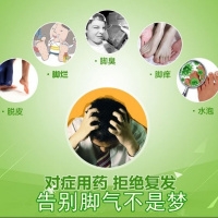 狼毒脚气喷剂脚气药套装去脚臭脚痒脱皮烂脚丫泡型止痒脚气药膏
