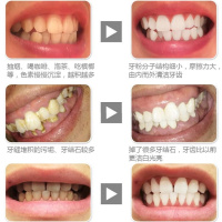 牙医推荐 一刷白 强效祛除牙烟牙黑牙烟渍茶渍牙菌洗牙粉50g