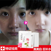[吴昕力荐 特证祛斑]祛斑面膜韩妙雪莲花蚕丝补水 淡斑褪黑祛 保湿修复提亮肤色10片/盒 玻尿酸收缩毛孔非海藻睡眠