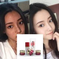 去斑燕窝素白里透红雪颜再生素完美五件套嫩白补水保湿淡斑护肤