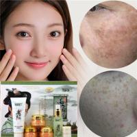 祛斑补水保湿淡斑霜五件套东方古韵白里透红套装护肤化妆品