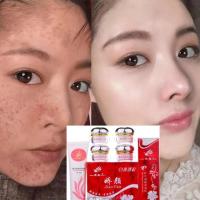 正品娇颜化妆品第二代白里透红保湿祛霜四合一套装护肤产品