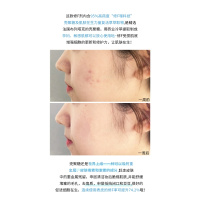 邮 小花坊韩国Dr.Althea壳聚糖小绷带急救修护保湿面膜