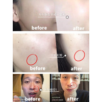 平价小灯泡!日本城野医生vc377淡斑精华液高浓度程野18g