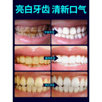 洗牙粉牙去烟牙渍牙垢口臭牙斑净非套餐牙齿神器