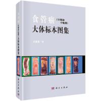 食管癌(早期和中晚期)大体标本图集