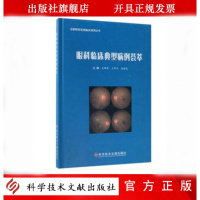 正版 眼科临床典型病例荟萃
