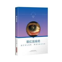【新华书店】正版 眼红斑痤疮王开文上海科学技术出版社9787547831168 书籍