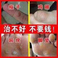 芙丽芳丝去鸡眼贴尤互去除膏贴茧肉刺猴子老茧足部去除死皮脚垫上趾脚